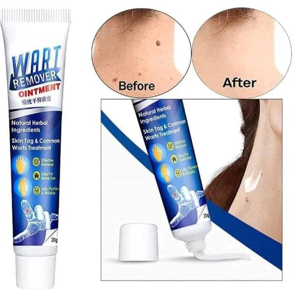 Salicylic Acid Wart Remover Black Head Removal Gel For Acne - Wart Remover (Pack of 2) Pack of 2 Wart Remover (Buy 1, Get 1 Free) Zaavio.co®