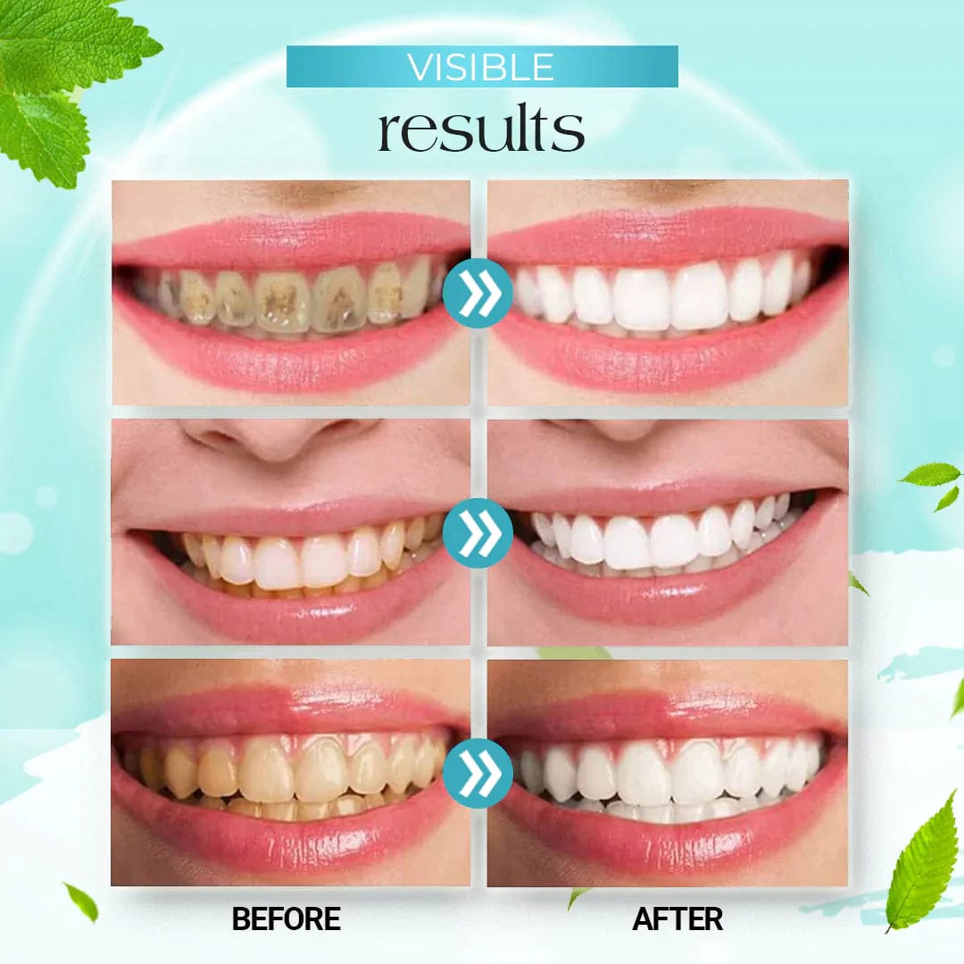 Teeth Whitening Mousse Foam Toothpaste Dental Stain Tartar Remover Foam Toothpaste