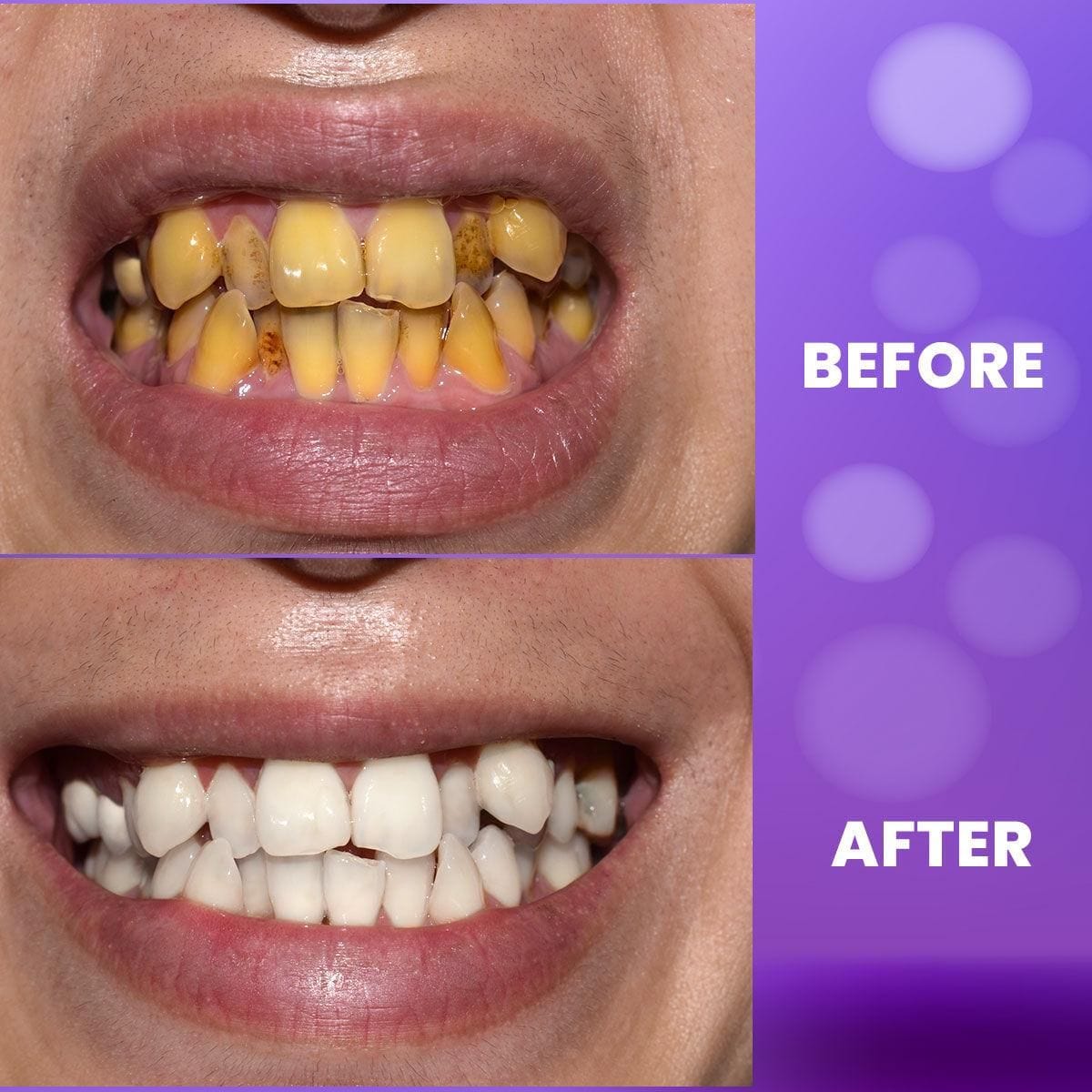 Teeth Whitening Tooth Paste Gel Whitening Pen Toothpaste- Purple Teeth Whitening Gel Purple Teeth Whitening Gel