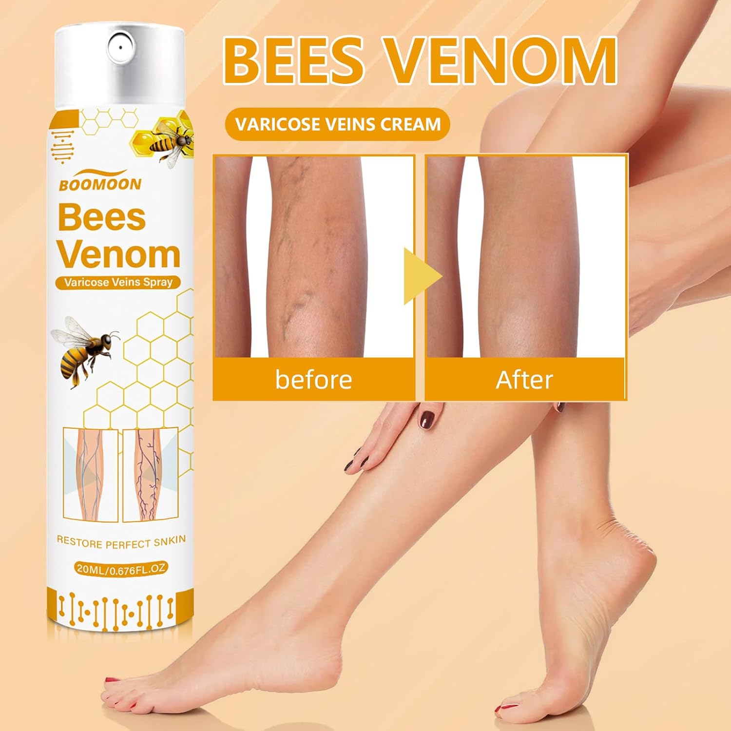 Varicose Veins Spray Bee Venom Varicose Veins Spray