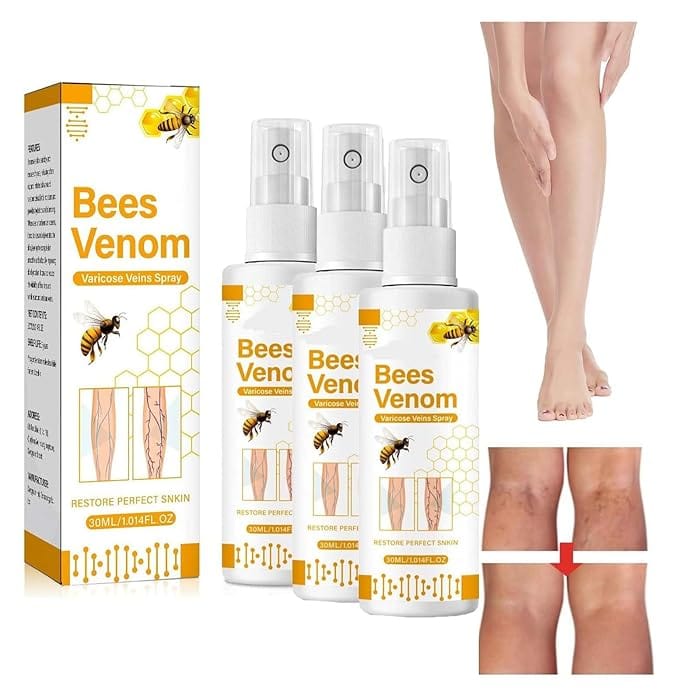 Varicose Veins Spray Bee Venom Varicose Veins Spray