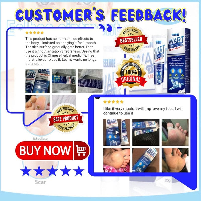 Wart Remover Ice Cream Mask Wart Remover Ice Cream Mask