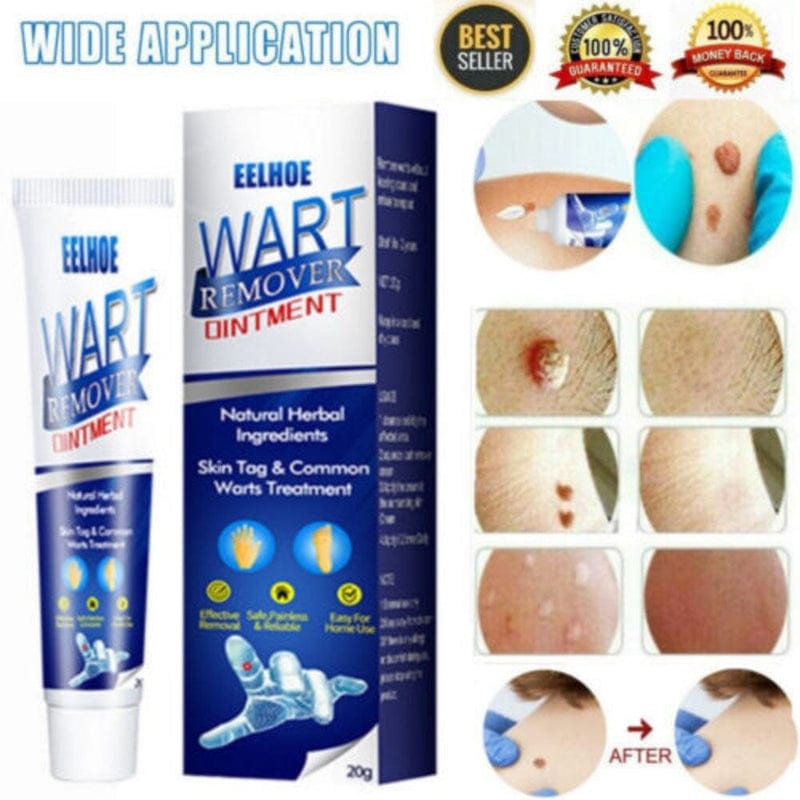 Wart Remover Ice Cream Mask Wart Remover Ice Cream Mask