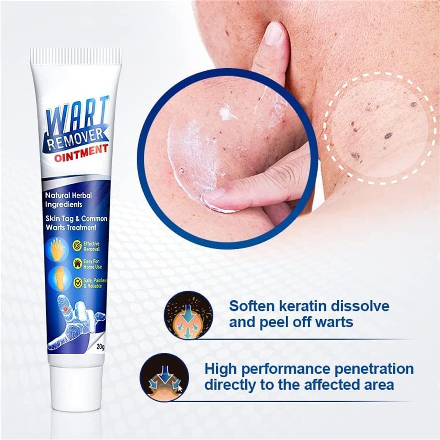 Wart Remover Ice Cream Mask Wart Remover Ice Cream Mask